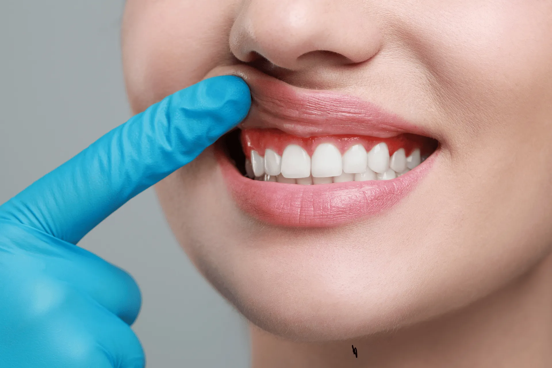 When to See a Dentist for Gum Overgrowth